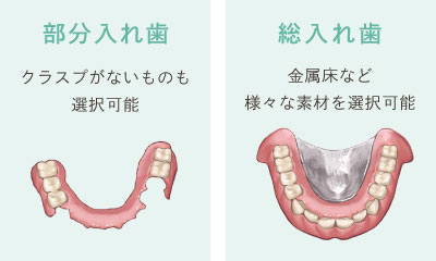 部分入れ歯(クラスプがないものも選択可能) 総入れ歯(金属床など様々な素材を選択可能)